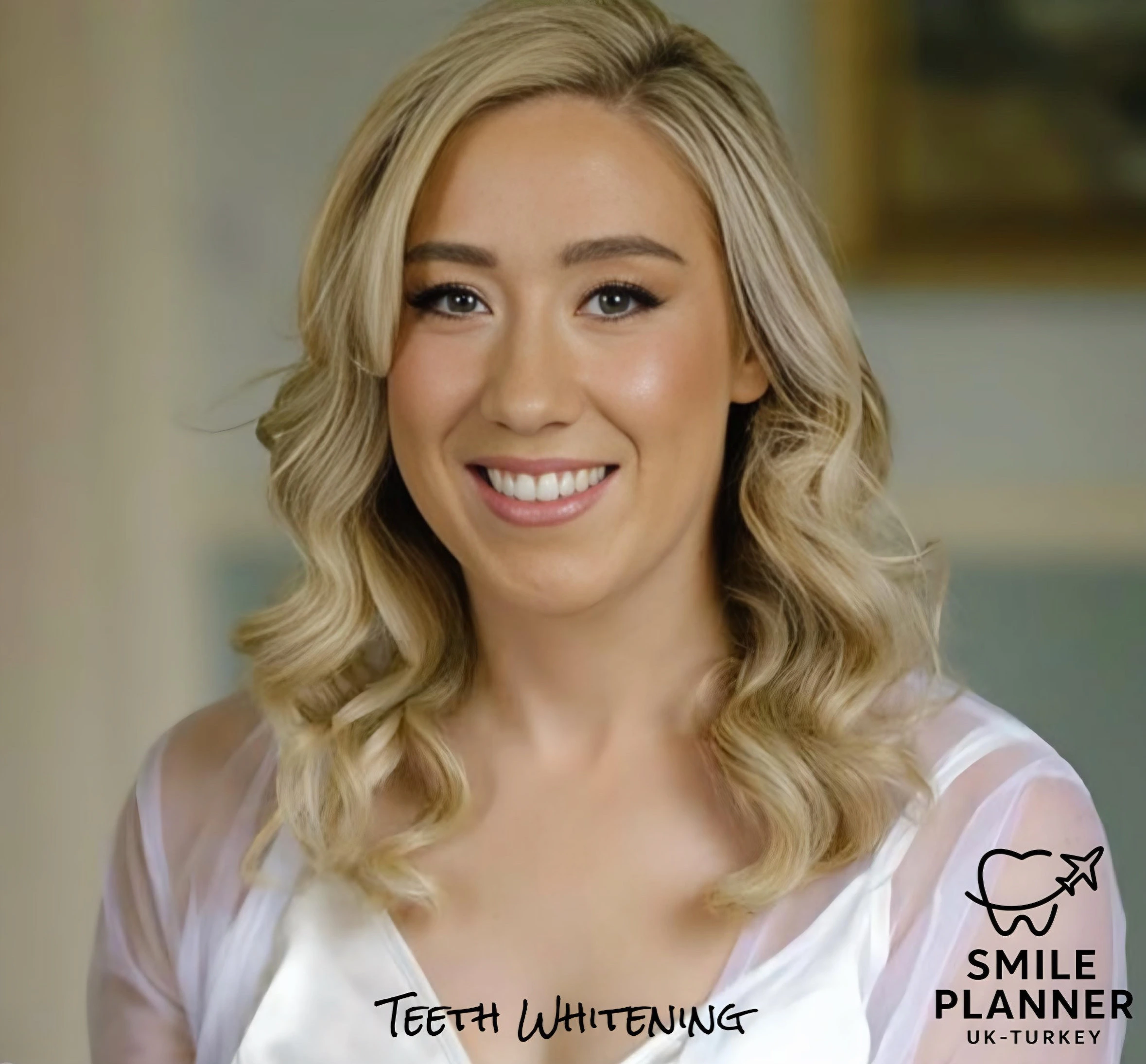 UK patient smile transformation all-on-5 in Turkey